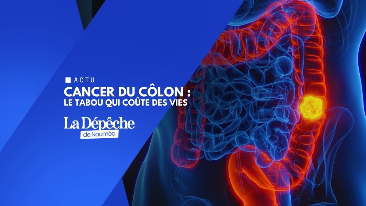 Mars Bleu : ce cancer tue en silence en Calédonie